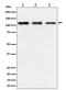 TAO Kinase 1 antibody, M07063, Boster Biological Technology, Western Blot image 