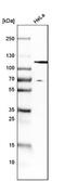 Hepatocyte Growth Factor-Regulated Tyrosine Kinase Substrate antibody, NBP1-83203, Novus Biologicals, Western Blot image 