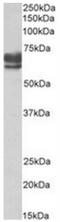 Peroxisomal Biogenesis Factor 5 antibody, NBP2-44324, Novus Biologicals, Western Blot image 