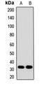 Mitochondrial carnitine/acylcarnitine carrier protein antibody, LS-C668537, Lifespan Biosciences, Western Blot image 