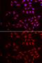 Cold Inducible RNA Binding Protein antibody, GTX33096, GeneTex, Immunofluorescence image 