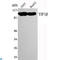 Tripartite Motif Containing 28 antibody, LS-C814132, Lifespan Biosciences, Western Blot image 