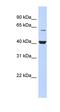 Phosphatidylinositol Glycan Anchor Biosynthesis Class K antibody, orb324879, Biorbyt, Western Blot image 