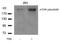 Mechanistic Target Of Rapamycin Kinase antibody, AP02480PU-N, Origene, Western Blot image 