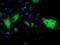 Monoglyceride lipase antibody, MA5-25551, Invitrogen Antibodies, Immunocytochemistry image 