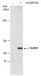 NLR family CARD domain-containing protein 4 antibody, GTX102366, GeneTex, Western Blot image 