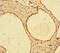 Inosine Monophosphate Dehydrogenase 2 antibody, CSB-PA01195A0Rb, Cusabio, Immunohistochemistry paraffin image 