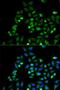 PD-L1 antibody, LS-C746930, Lifespan Biosciences, Immunofluorescence image 