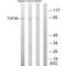 DNA Topoisomerase III Beta antibody, A10446, Boster Biological Technology, Western Blot image 