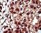 Diacylglycerol Kinase Iota antibody, PA5-15408, Invitrogen Antibodies, Immunohistochemistry frozen image 