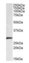 Snail Family Transcriptional Repressor 1 antibody, orb19327, Biorbyt, Western Blot image 