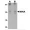 Ribosomal Oxygenase 2 antibody, MBS151289, MyBioSource, Western Blot image 