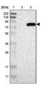 Procollagen-Lysine,2-Oxoglutarate 5-Dioxygenase 3 antibody, NBP1-81307, Novus Biologicals, Western Blot image 