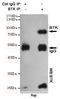 Bruton Tyrosine Kinase antibody, STJ99116, St John