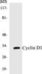 Cyclin D1 antibody, EKC1153, Boster Biological Technology, Western Blot image 