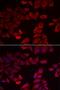 Selenophosphate Synthetase 1 antibody, LS-C334730, Lifespan Biosciences, Immunofluorescence image 