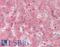 Vitronectin antibody, LS-B10245, Lifespan Biosciences, Immunohistochemistry frozen image 