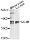 Melanocortin 1 Receptor antibody, LS-C332324, Lifespan Biosciences, Western Blot image 