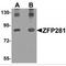 ZFP281 antibody, MBS151071, MyBioSource, Western Blot image 
