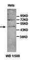 Arylacetamide Deacetylase Like 3 antibody, orb77457, Biorbyt, Western Blot image 