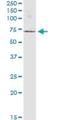 Endonuclease/Exonuclease/Phosphatase Family Domain Containing 1 antibody, H00080820-B03P, Novus Biologicals, Western Blot image 