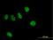 Zinc Finger Protein 484 antibody, H00083744-B01P, Novus Biologicals, Immunofluorescence image 