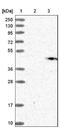 Gamma-Glutamyl Hydrolase antibody, NBP1-90927, Novus Biologicals, Immunohistochemistry frozen image 