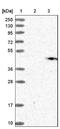 Gamma-glutamyl hydrolase antibody, NBP1-90927, Novus Biologicals, Immunohistochemistry frozen image 