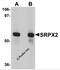 Sushi Repeat Containing Protein X-Linked 2 antibody, 5475, ProSci, Western Blot image 