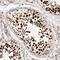 Cell Division Cycle Associated 2 antibody, NBP1-87140, Novus Biologicals, Immunohistochemistry frozen image 
