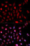 SET1 antibody, 19-635, ProSci, Immunofluorescence image 