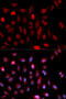 ASH2 Like, Histone Lysine Methyltransferase Complex Subunit antibody, 19-635, ProSci, Immunofluorescence image 