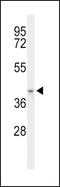 Acyl-CoA Dehydrogenase Family Member 8 antibody, PA5-26497, Invitrogen Antibodies, Western Blot image 