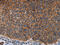 Junction Plakoglobin antibody, CSB-PA950440, Cusabio, Immunohistochemistry paraffin image 