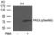 Protein Kinase C Theta antibody, PA5-37697, Invitrogen Antibodies, Western Blot image 