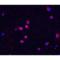 Checkpoint Kinase 2 antibody, LS-B1348, Lifespan Biosciences, Immunofluorescence image 