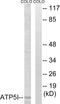 ATP Synthase Membrane Subunit E antibody, PA5-39034, Invitrogen Antibodies, Western Blot image 