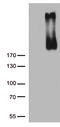 Erb-B2 Receptor Tyrosine Kinase 3 antibody, LS-C793936, Lifespan Biosciences, Western Blot image 