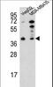 Poly(ADP-Ribose) Polymerase Family Member 16 antibody, LS-C163370, Lifespan Biosciences, Western Blot image 