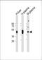 Haptoglobin antibody, A00062-3, Boster Biological Technology, Western Blot image 