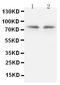 Protein Kinase C Gamma antibody, PA1234, Boster Biological Technology, Western Blot image 