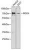 Mesothelin antibody, 22-043, ProSci, Western Blot image 