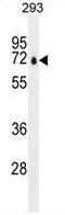 Poly(ADP-Ribose) Polymerase Family Member 12 antibody, GTX81906, GeneTex, Western Blot image 
