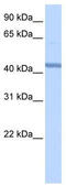 RNA Binding Motif Protein 22 antibody, TA343866, Origene, Western Blot image 