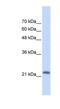 RAS Like Family 10 Member A antibody, NBP1-58920, Novus Biologicals, Western Blot image 