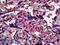 SMAD Family Member 3 antibody, LS-B5459, Lifespan Biosciences, Immunohistochemistry paraffin image 