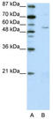Zinc Finger Protein 329 antibody, TA345391, Origene, Western Blot image 