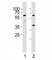 Receptor Interacting Serine/Threonine Kinase 3 antibody, F50172-0.4ML, NSJ Bioreagents, Immunohistochemistry paraffin image 