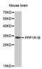 Protein Phosphatase 1 Regulatory Inhibitor Subunit 1B antibody, abx000785, Abbexa, Western Blot image 