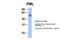 Promyelocytic Leukemia antibody, 25-112, ProSci, Western Blot image 